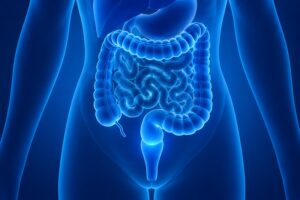 Lucha contra el Cáncer de Colon,